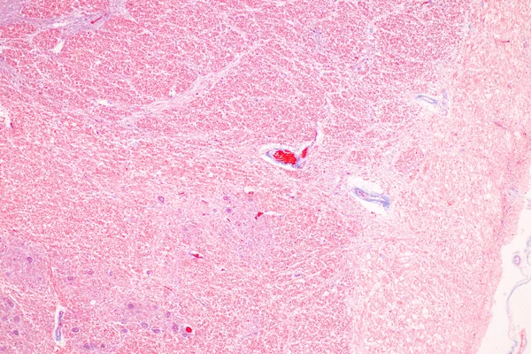 Cerebello Talamo Midollo Allungato Midollo Spinale Neurone Motorio Umano Microscopio — Foto Stock