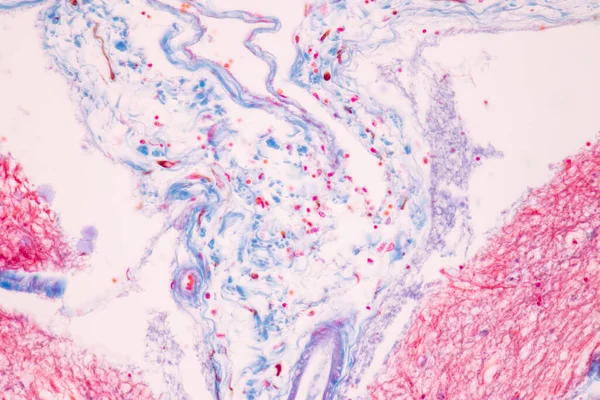 Cerebellum Thalamus Medulla Oblongata Medula Espinhal Neurônio Motor Humano Sob — Fotografia de Stock