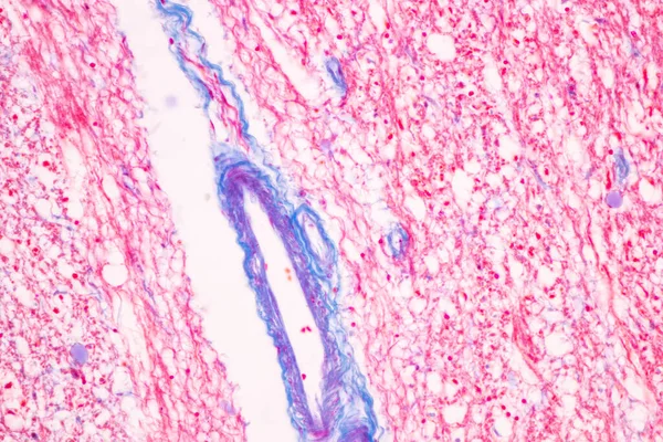 Kleinhirn Thalamus Medulla Oblongata Rückenmark Und Motor Neuron Human Unter — Stockfoto