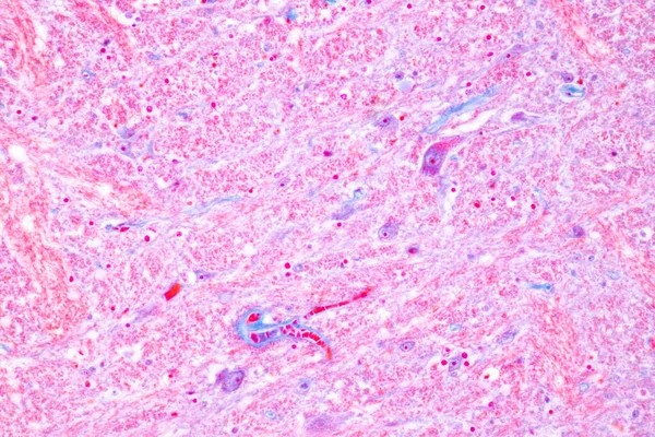 Cerebellum Thalamus Medulla Oblongata Rdzeń Kręgowy Neuron Ruchowy Człowieka Pod — Zdjęcie stockowe