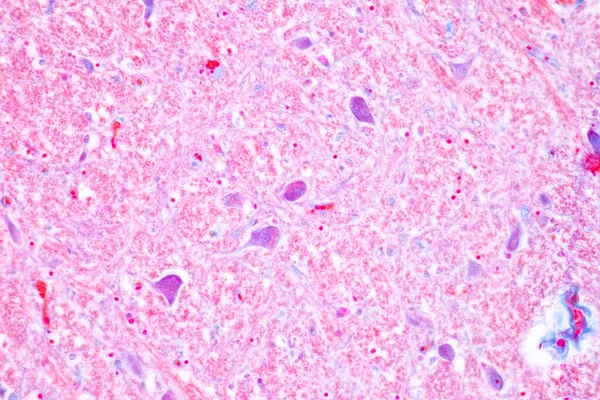 Церебеллум Таламус Продолговатая Медулла Спинной Мозг Двигательный Нейрон Человека Микроскопом — стоковое фото
