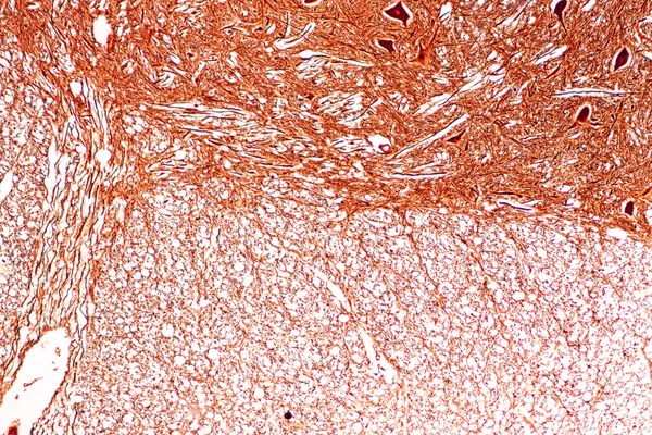 Cerebellum Thalamus Medulla Oblongata Spinal Cord Motor Neuron Člověk Pod — Stock fotografie