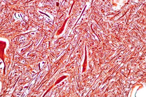 Cerebellum Thalamus Medulla Oblongata Ryggmärg Och Motor Neuron Människa Mikroskop — Stockfoto
