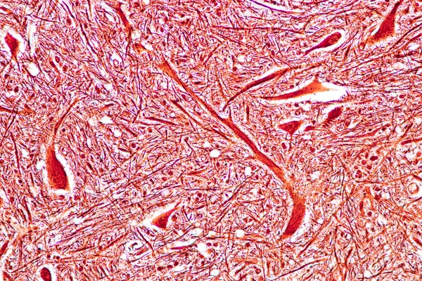 研究室で顕微鏡下の小脳 タラムス メデュラ オロンガタ 運動ニューロン — ストック写真