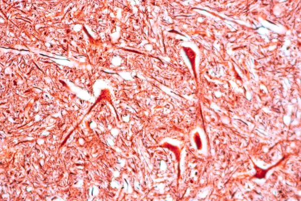 研究室で顕微鏡下の小脳 タラムス メデュラ オロンガタ 運動ニューロン — ストック写真