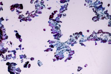 Eğitim için mikroskop altında Lichen, hyphae ve Symbiotic alglerin özellikleri.