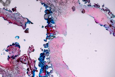 Eğitim için mikroskop altında Lichen, hyphae ve Symbiotic alglerin özellikleri.