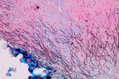 Eğitim için mikroskop altında Lichen, hyphae ve Symbiotic alglerin özellikleri.