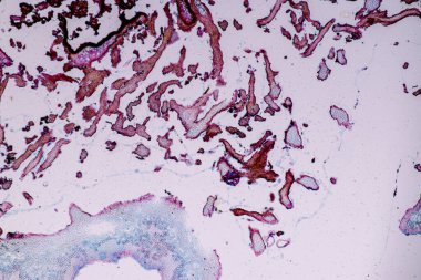 Eğitim için mikroskop altında Lichen, hyphae ve Symbiotic alglerin özellikleri.