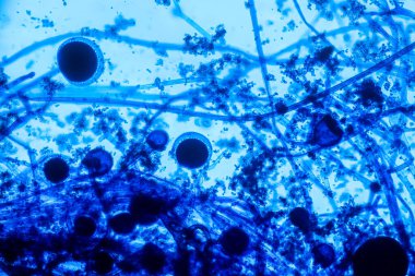 Rhizopus 'un özellikleri, eğitim için mikroskop altında kayan yaygın bir safirik mantar cinsidir..