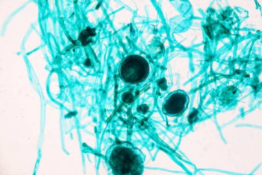 Rhizopus 'un özellikleri, eğitim için mikroskop altında kayan yaygın bir safirik mantar cinsidir..