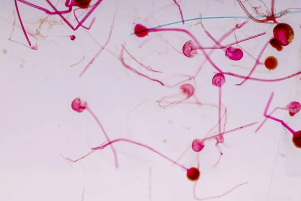 地下茎の特徴は 教育のための顕微鏡下でスライド上の一般的な腐生菌の属です — ストック写真