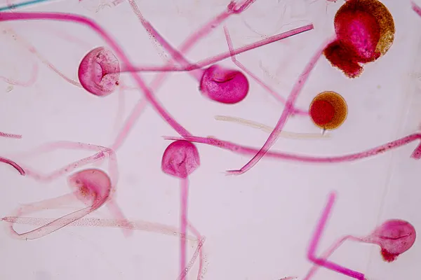 Characteristics Rhizopus Genus Common Saprophytic Fungi Slide Microscope Education — Stock Photo, Image