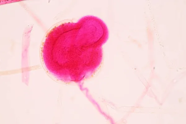 Характеристики Rhizopus Рід Поширених Сапрофітичних Грибів Слизі Під Мікроскопом Освіти — стокове фото