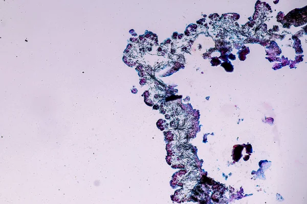 教育用顕微鏡下でのライヘン ハイフェー 共生藻類の特性 — ストック写真