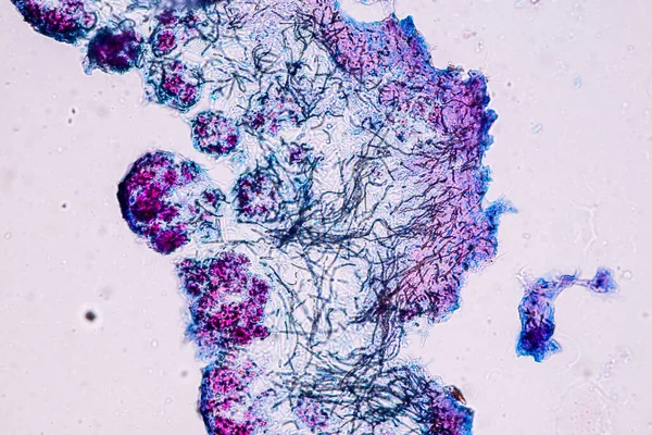 Eğitim Için Mikroskop Altında Lichen Hyphae Symbiotic Alglerin Özellikleri — Stok fotoğraf
