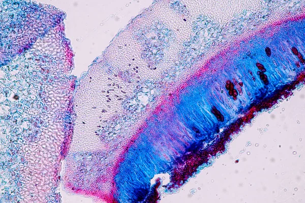 Kännetecken För Lavar Hyfer Och Symbiotiska Alger Mikroskop För Utbildning — Stockfoto