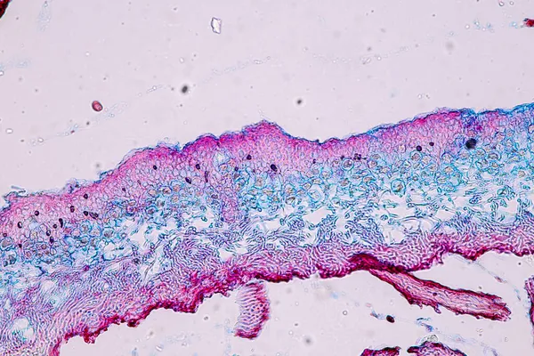 Características Líquen Hifas Algas Simbióticas Sob Microscópio Para Educação — Fotografia de Stock