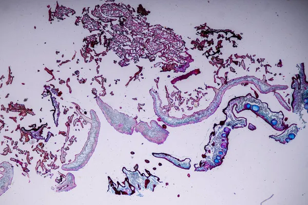 Merkmale Von Flechten Hyphen Und Symbiotischen Algen Unter Dem Mikroskop — Stockfoto