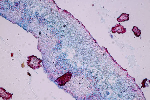 Características Líquen Hifas Algas Simbióticas Sob Microscópio Para Educação — Fotografia de Stock