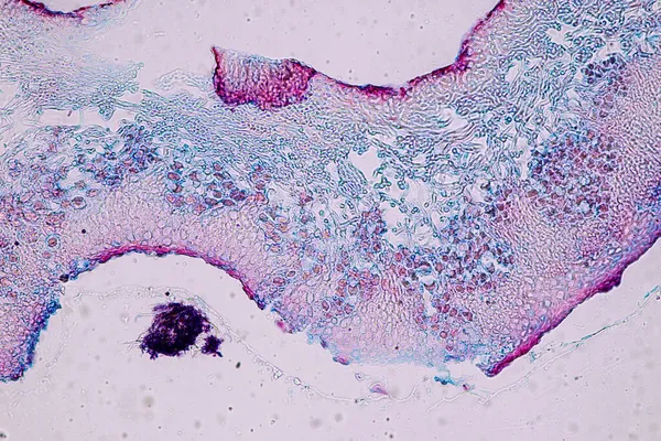 Características Del Liquen Las Hifas Las Algas Simbióticas Bajo Microscopio — Foto de Stock