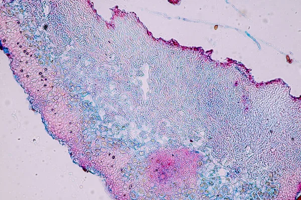 Χαρακτηριστικά Των Φυκιών Lichen Hyphae Και Symbiotic Στο Μικροσκόπιο Για — Φωτογραφία Αρχείου