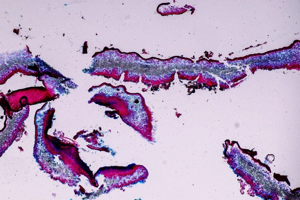 Zuzmó Hiphae Szimbiotikus Algák Jellemzői Oktatás Mikroszkópja Alatt — Stock Fotó
