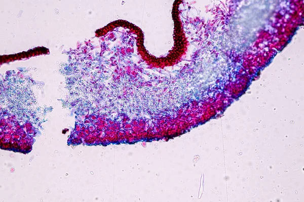 Kännetecken För Lavar Hyfer Och Symbiotiska Alger Mikroskop För Utbildning — Stockfoto