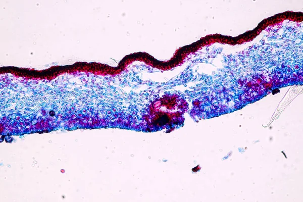 Características Del Liquen Las Hifas Las Algas Simbióticas Bajo Microscopio —  Fotos de Stock