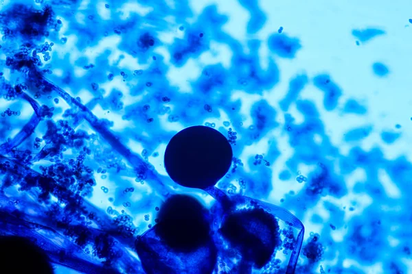 Rhizopus Özellikleri Eğitim Için Mikroskop Altında Kayan Yaygın Bir Safirik — Stok fotoğraf