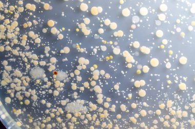 Özellikler ve Farklı şekilli Bakteri ve Küf Kolonisi mikrobiyoloji laboratuarındaki eğitim için toprak örneklerinden tarım plakalarında büyüyor..