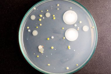 Özellikler ve Farklı şekilli Bakteri ve Küf Kolonisi mikrobiyoloji laboratuarındaki eğitim için toprak örneklerinden tarım plakalarında büyüyor..