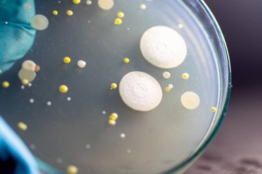 Özellikler ve Farklı şekilli Bakteri ve Küf Kolonisi mikrobiyoloji laboratuarındaki eğitim için toprak örneklerinden tarım plakalarında büyüyor..