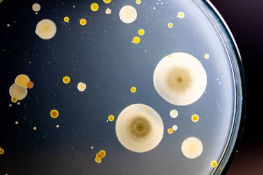 Özellikler ve Farklı şekilli Bakteri ve Küf Kolonisi mikrobiyoloji laboratuarındaki eğitim için toprak örneklerinden tarım plakalarında büyüyor..