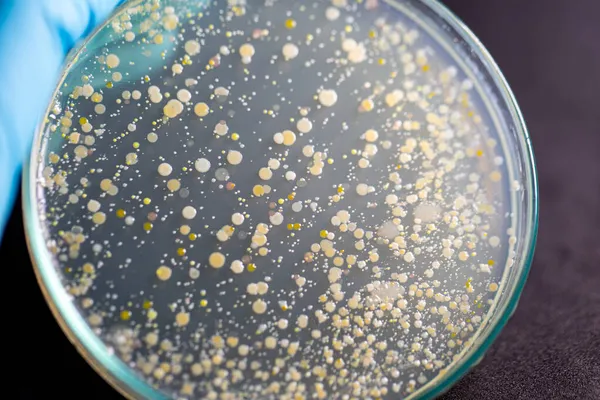 Antecedentes Características Colônia Bactérias Moldes Forma Diferente Crescendo Placas Ágar — Fotografia de Stock