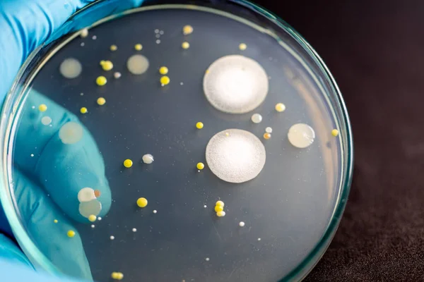 미생물 실험실에서 교육을 샘플을 질그릇 위에서 자라는 형태의 박테리아와 곰팡이의 — 스톡 사진