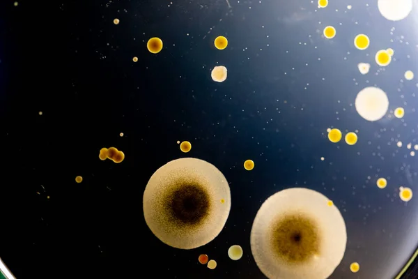 Antecedentes Características Diferentes Formas Colonia Bacterias Moho Que Crece Placas — Foto de Stock