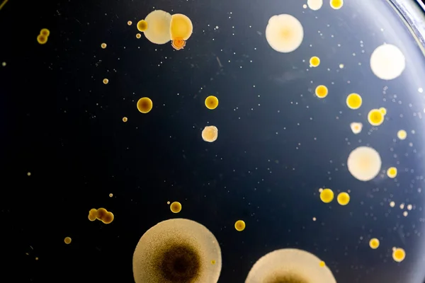 Tła Charakterystyczne Różnokształtna Kolonia Bakterii Pleśni Rosnąca Płytkach Agaru Próbek — Zdjęcie stockowe