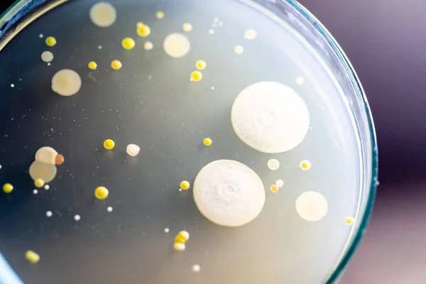 Özellikler Farklı Şekilli Bakteri Küf Kolonisi Mikrobiyoloji Laboratuarındaki Eğitim Için — Stok fotoğraf