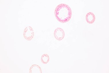 Hydra, Cnidaria cinsi ve Hydrozoa sınıfı eğitim için mikroskop altında bulunan küçük, tatlı su hayvanlarından oluşan bir cinstir..
