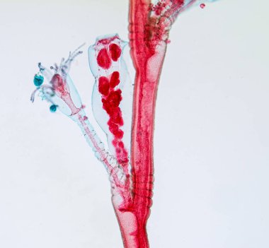 Hydra, Cnidaria cinsi ve Hydrozoa sınıfı eğitim için mikroskop altında bulunan küçük, tatlı su hayvanlarından oluşan bir cinstir..