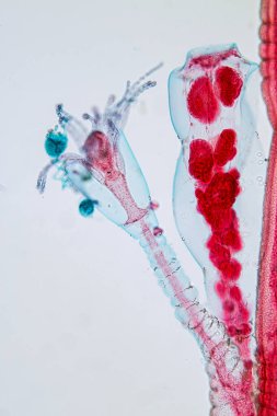 Hydra, Cnidaria cinsi ve Hydrozoa sınıfı eğitim için mikroskop altında bulunan küçük, tatlı su hayvanlarından oluşan bir cinstir..