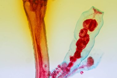 Hydra, Cnidaria cinsi ve Hydrozoa sınıfı eğitim için mikroskop altında bulunan küçük, tatlı su hayvanlarından oluşan bir cinstir..