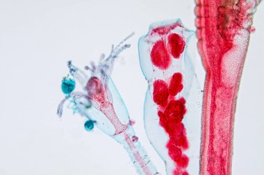 Hydra, Cnidaria cinsi ve Hydrozoa sınıfı eğitim için mikroskop altında bulunan küçük, tatlı su hayvanlarından oluşan bir cinstir..