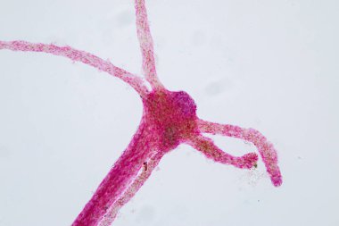 Hydra, Cnidaria cinsi ve Hydrozoa sınıfı eğitim için mikroskop altında bulunan küçük, tatlı su hayvanlarından oluşan bir cinstir..