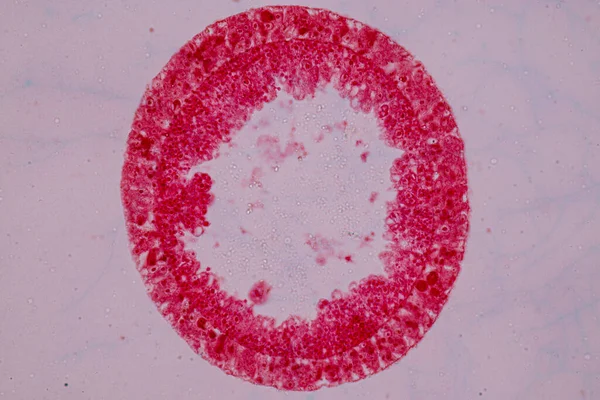 Hydra, Cnidaria cinsi ve Hydrozoa sınıfı eğitim için mikroskop altında bulunan küçük, tatlı su hayvanlarından oluşan bir cinstir..