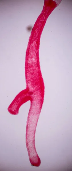Hydra Cnidaria Cinsi Hydrozoa Sınıfı Eğitim Için Mikroskop Altında Bulunan — Stok fotoğraf