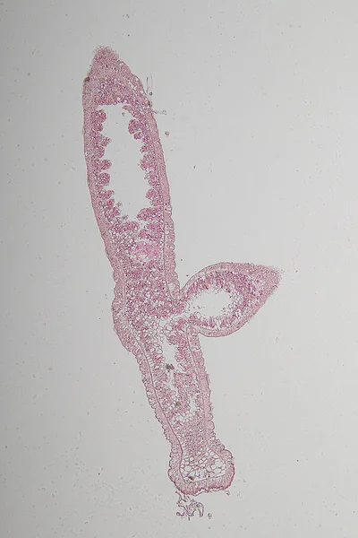 Hydra Genere Piccoli Animali Acqua Dolce Del Phylum Cnidaria Classe — Foto Stock