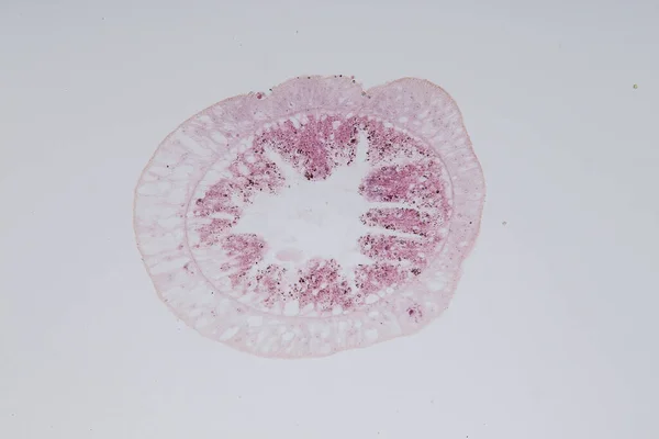 ヒドラは 教育のための顕微鏡の下でキダリアとクラスHydrozoaの小さな 淡水動物の属です — ストック写真