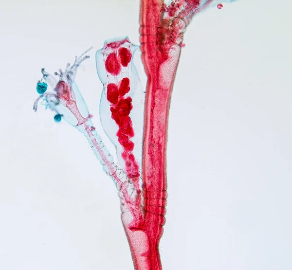 Hydra, Cnidaria cinsi ve Hydrozoa sınıfı eğitim için mikroskop altında bulunan küçük, tatlı su hayvanlarından oluşan bir cinstir..